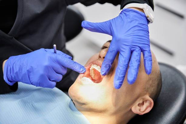 Best Emergency Wisdom Tooth Extraction in Del Rey Oaks, CA