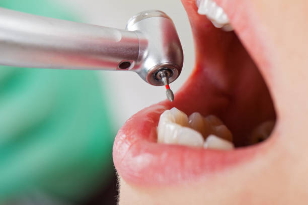 Best Emergency Cosmetic Dentistry (e.g., broken veneers) in Del Rey Oaks, CA